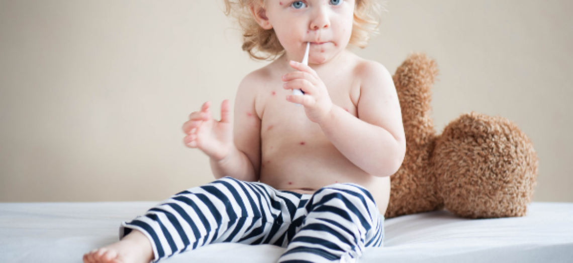 Mi hijo tiene manchas en la piel, ¿Qué hago?