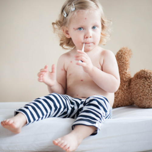 Mi hijo tiene manchas en la piel, ¿Qué hago?